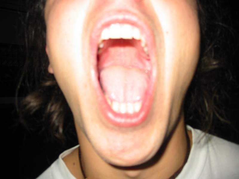 Píno a jeho zuby (Kliknutďż˝m se obrďż˝zek zavďż˝e)